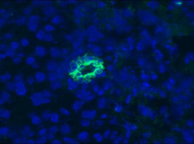 IHC-plus™ KRT7 / CK7 / Cytokeratin 7 Antibody (clone RCK105)