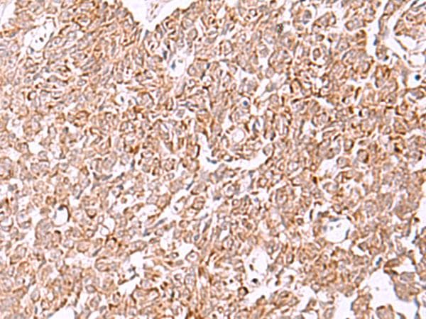IRX2 Antibody