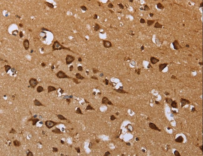 IHC-plus™ Polyclonal Rabbit anti-Human EPOR / EPO Receptor Antibody (aa31-79, IHC)