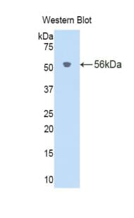 IL18BP Antibody (aa29-193)