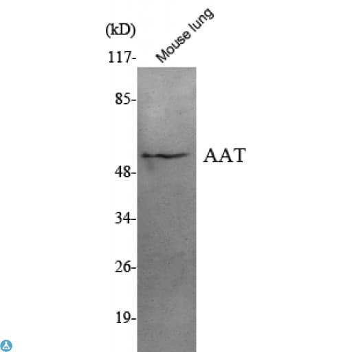 SERPINA1 / Alpha 1 Antitrypsin Antibody (aa320-350)