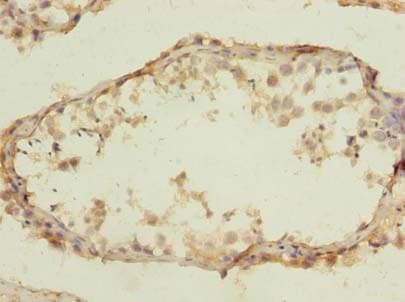 Polyclonal Rabbit anti-Human CLEC4C / CD303 / BDCA-2 Antibody (IHC)