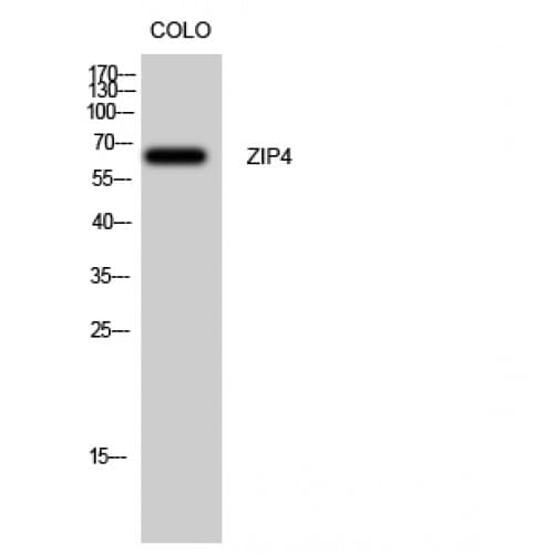SLC39A4 / ZIP4 Antibody (400-480 aa, Internal)