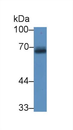 APP / Beta Amyloid Precursor Antibody (aa18-286)