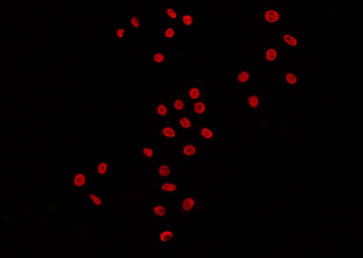 Polyclonal Rabbit anti-Human DNMT3B Antibody (IHC, IF, WB)