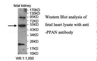 Polyclonal Rabbit anti-Human PPAN Antibody (aa184-307, IHC, WB)