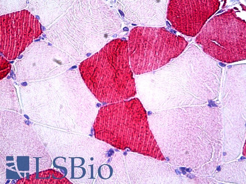 IHC-plus™ UBE2O Antibody (aa1279-1292)
