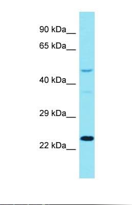 DCAF17 / C2orf37 Antibody (aa276-325)