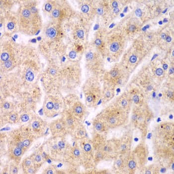 Polyclonal Rabbit anti-Human TXNRD2 Antibody (IHC, WB)