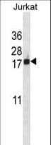 Polyclonal Rabbit anti-Human BANF1 / BAF / BCRP1 Antibody (aa37-65, IHC, WB)