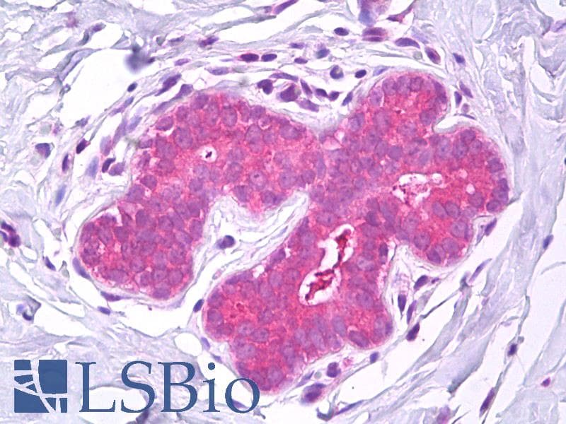 IHC-plus™ IST1 Antibody
