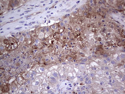 Monoclonal Mouse anti-Human PLAU / Urokinase / uPA Antibody (clone OTI5H4, aa107-379, IHC, WB)