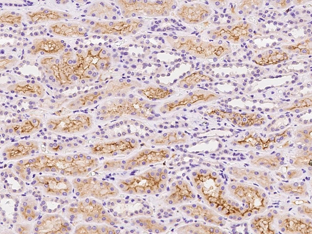 SLCO4C1 Antibody