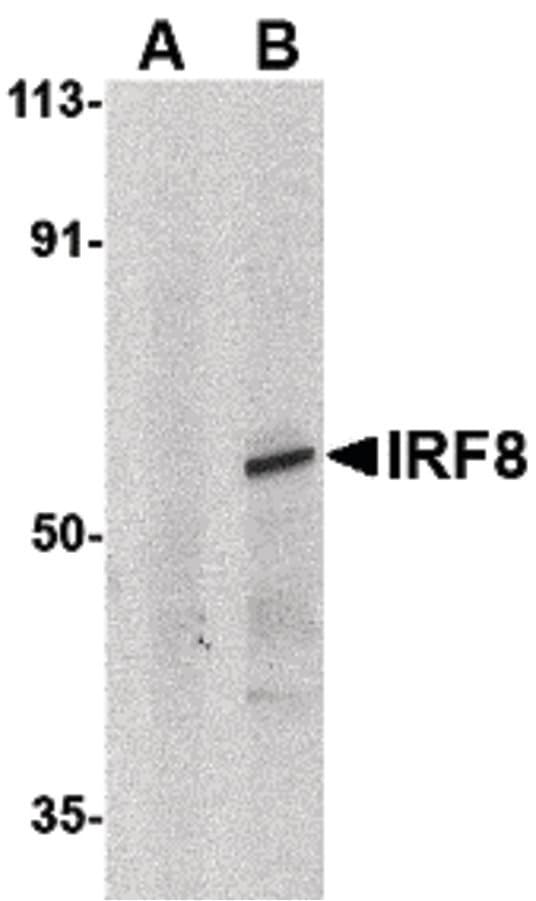 IHC-plus™ ICSBP / IRF8 Antibody