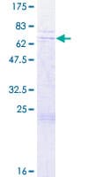 Human HSPC304 / C7orf64 Protein (Recombinant GST)