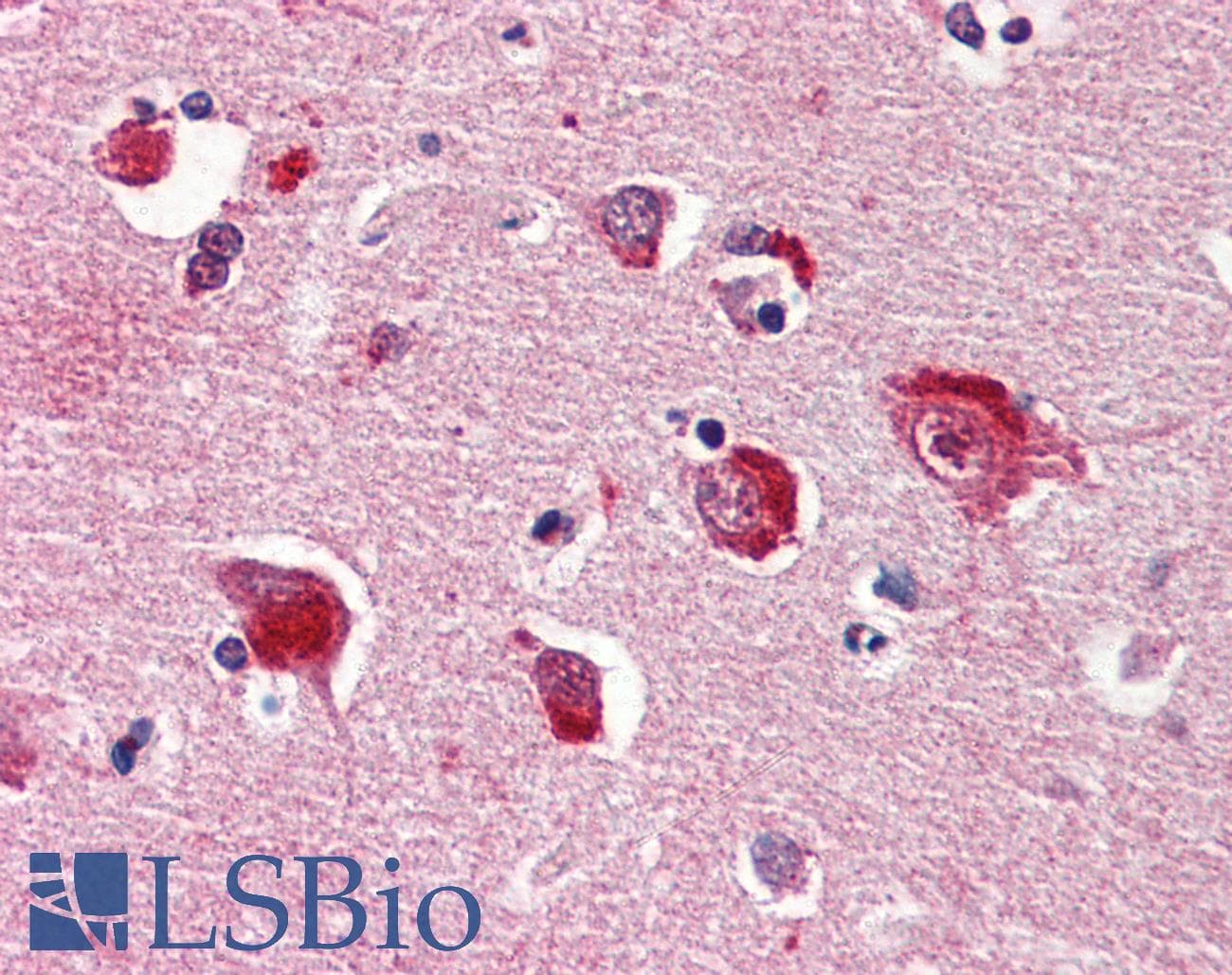 IHC-plus™ Monoclonal Mouse anti-Human PPP1CA / PP1-Alpha Antibody (clone 4G3, aa30-299, IHC, WB)