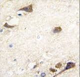 Polyclonal Rabbit anti-Human ACHE / Acetylcholinesterase Antibody (aa147-175, IHC, IF, WB)