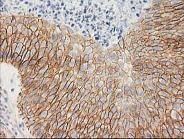 CTNNB1 / Beta Catenin Antibody (clone OTI1B11)