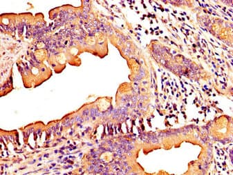 Polyclonal Rabbit anti-Human MID1IP1 Antibody (IHC)