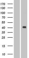 LMX1A Protein (Over-Expression Lysate Myc-DDK (Flag))