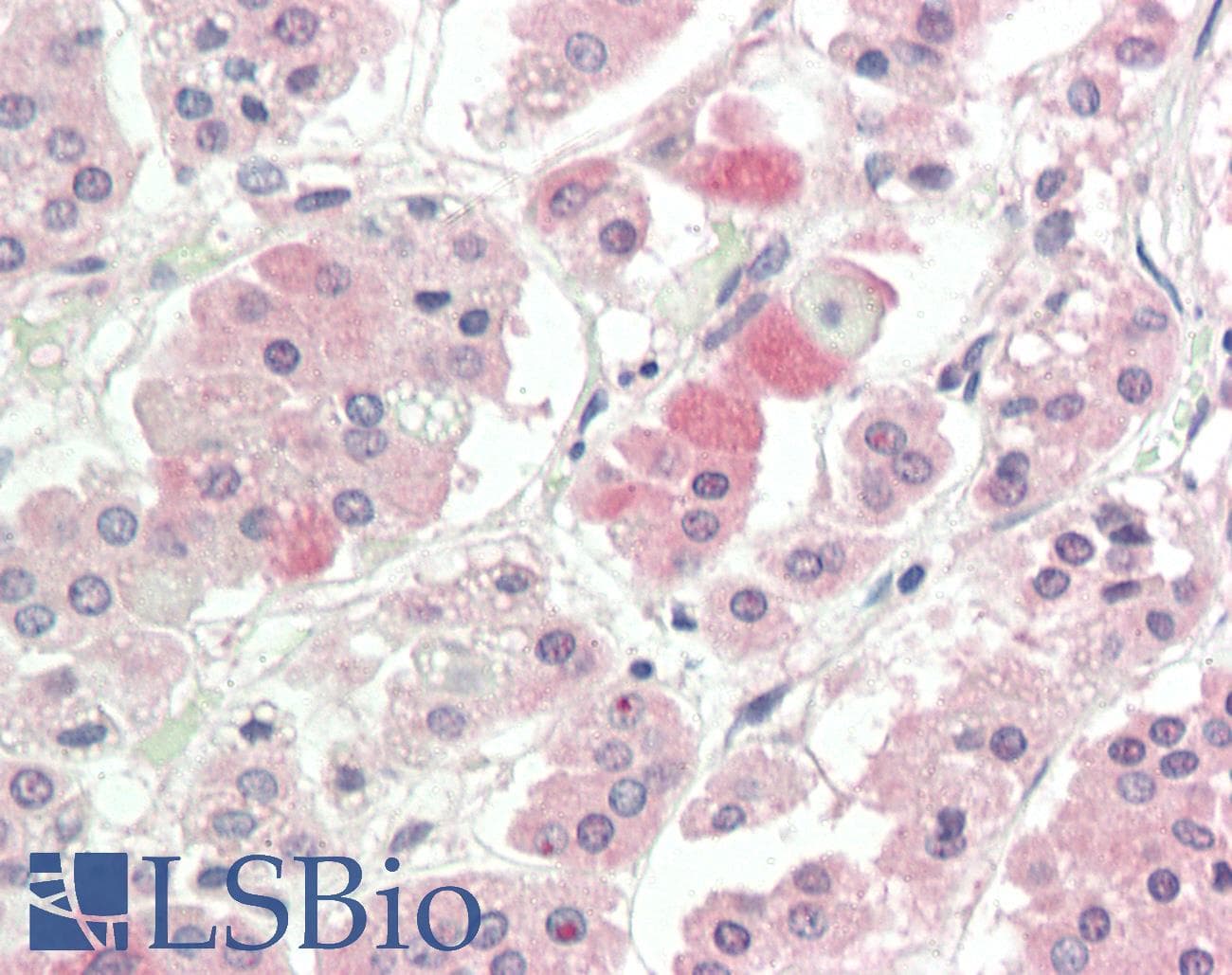 SLC1A4 / ASCT1 Antibody (C-Terminus, FITC)