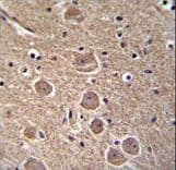 SIP / TP53INP1 Antibody (aa36-64)