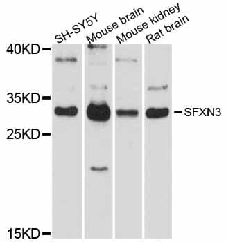 SFXN3 / Sideroflexin 3 Antibody