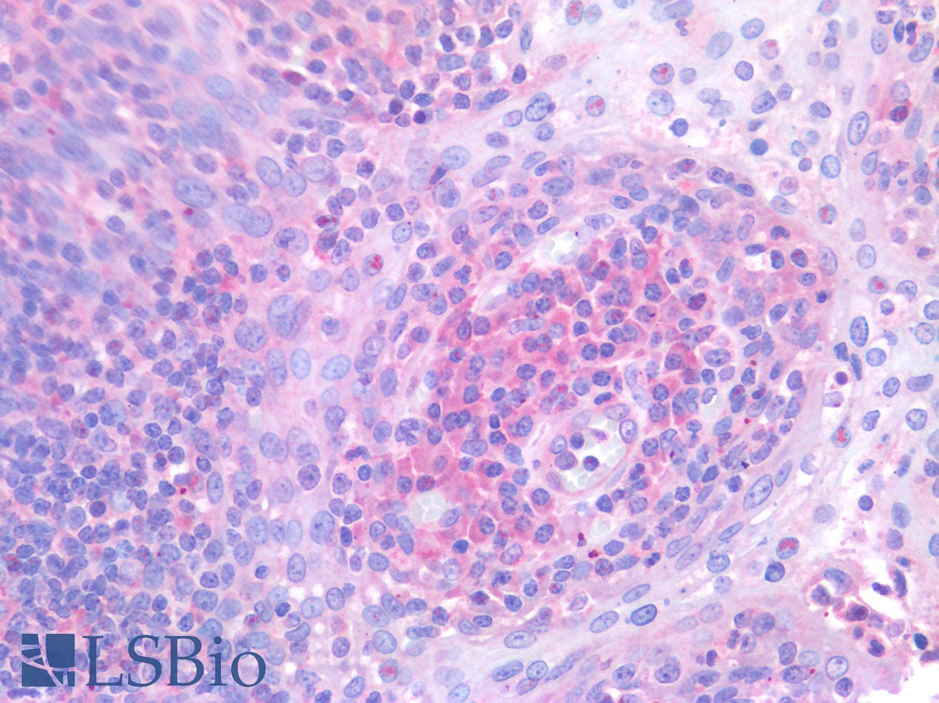 IHC-plus™ MYC / c-Myc Antibody