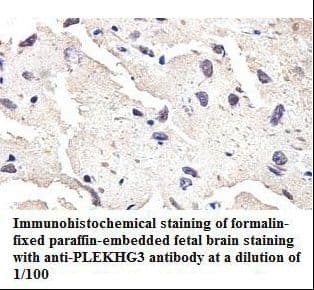 PLEKHG3 Antibody (aa58-350)