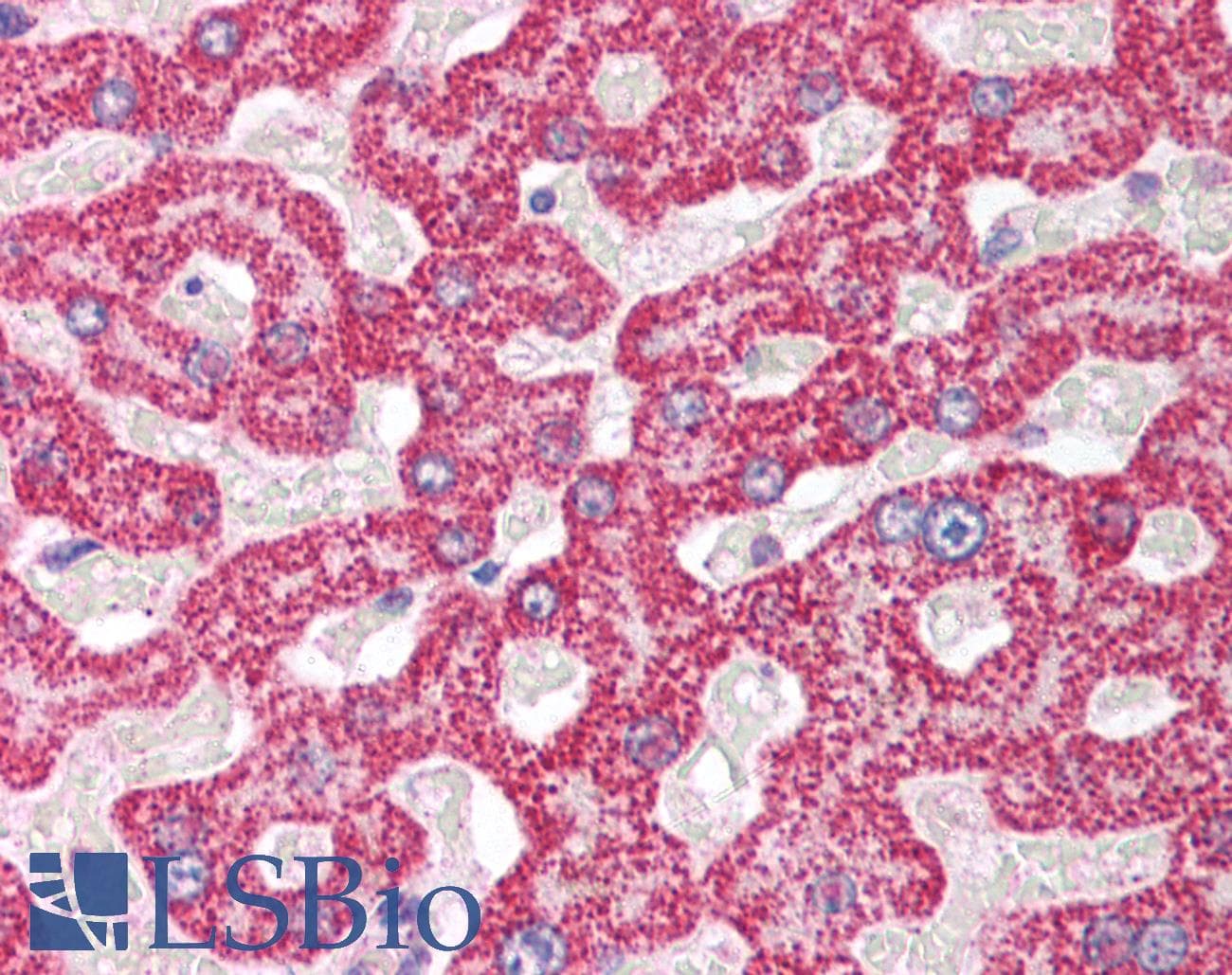 Polyclonal Rabbit anti-Human POLR2B / RPB2 Antibody (aa805-854, IHC, WB)