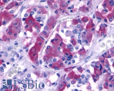 PathPlus™ Polyclonal Rabbit anti-Human B1R / BDKRB1 Antibody (C-Terminus, IHC)