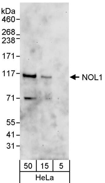 NOP2 Antibody (aa762-812)