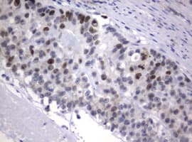 Monoclonal Rat anti-Human MKI67 / Ki67 Antibody (clone OTI9C3, IHC, WB)