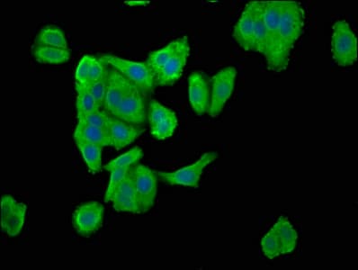SDCCAG3 Antibody