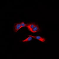 MCL1 / MCL 1 Antibody (phospho-Ser159)