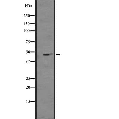 Polyclonal Rabbit anti-Human KCNJ4 / Kir2.3 Antibody (IF, WB)