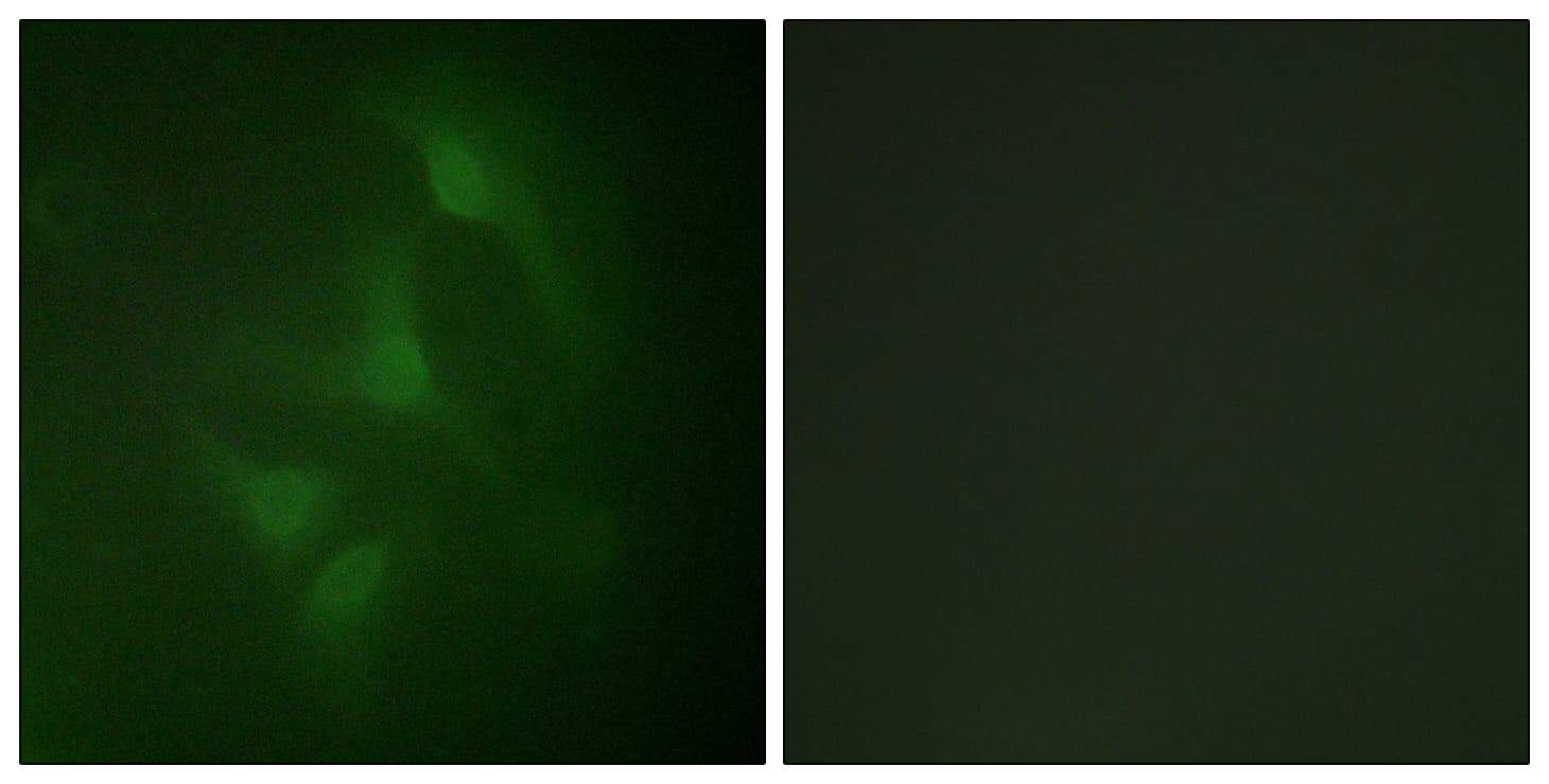 JNK1+2+3 Antibody (Internal)
