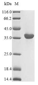 Human HLA-A Protein (Recombinant 6His, N-terminus)