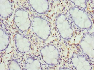 Kv10.1 / KCNH1 Antibody