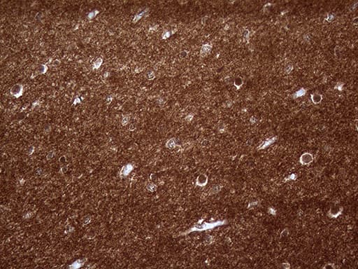Monoclonal Mouse anti-Human PRRT2 Antibody (clone OTI9H8, aa152-268, IHC, WB)