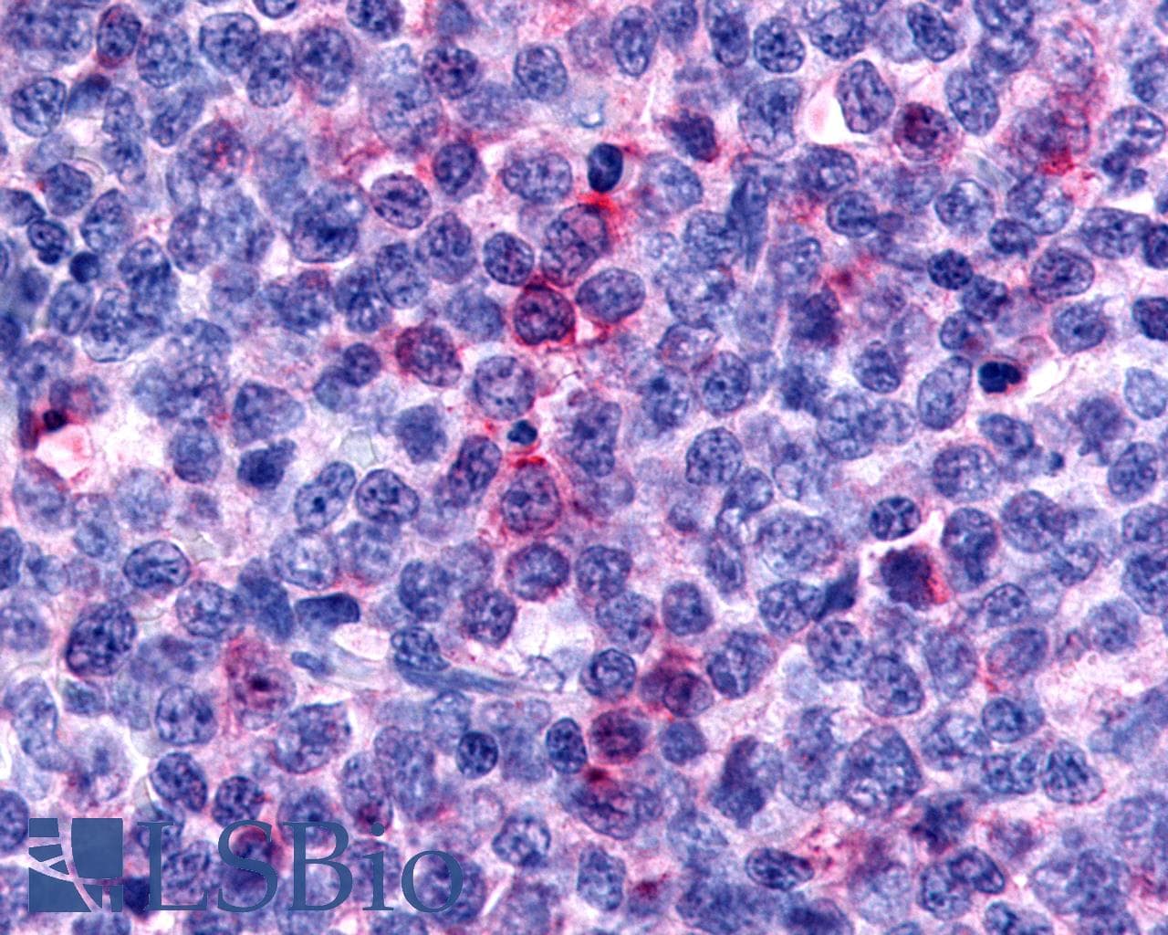 PathPlus™ CCR8 / CD198 Antibody (C-Terminus)