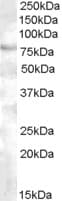 IHC-plus™ FOXP2 Antibody (aa611-623)