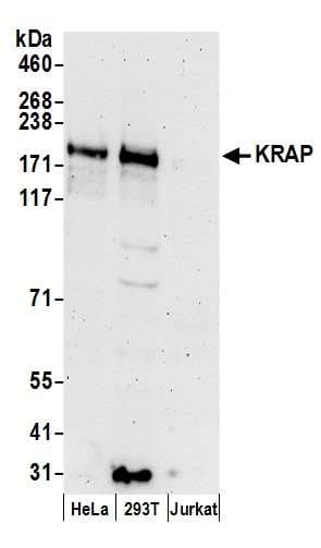 Polyclonal Rabbit anti-Human SSFA2 Antibody (aa1209-1259, WB)