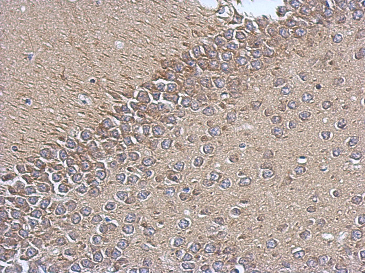 TIMM17A / TIM17 Antibody