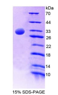 Human TFB1 / GTF2H1 Protein (Recombinant His-T7)