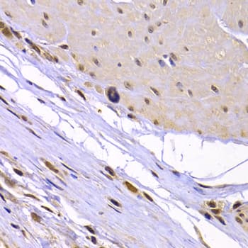 XRCC6 / Ku70 Antibody