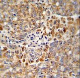 PCA1 / ALKBH3 Antibody (aa242-269)