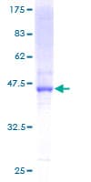 Human DHRS11 / MGC4172 Protein (Recombinant GST)
