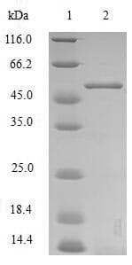 Mouse GPC4 / Glypican 4 Protein (Recombinant 6His-SUMO, N-terminus)