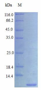 Human EREG / Epiregulin Protein (Recombinant)